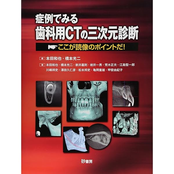 決定版 実践マニュアル 歯科用CTの見かた・読みかた | 森本 泰宏, 金田