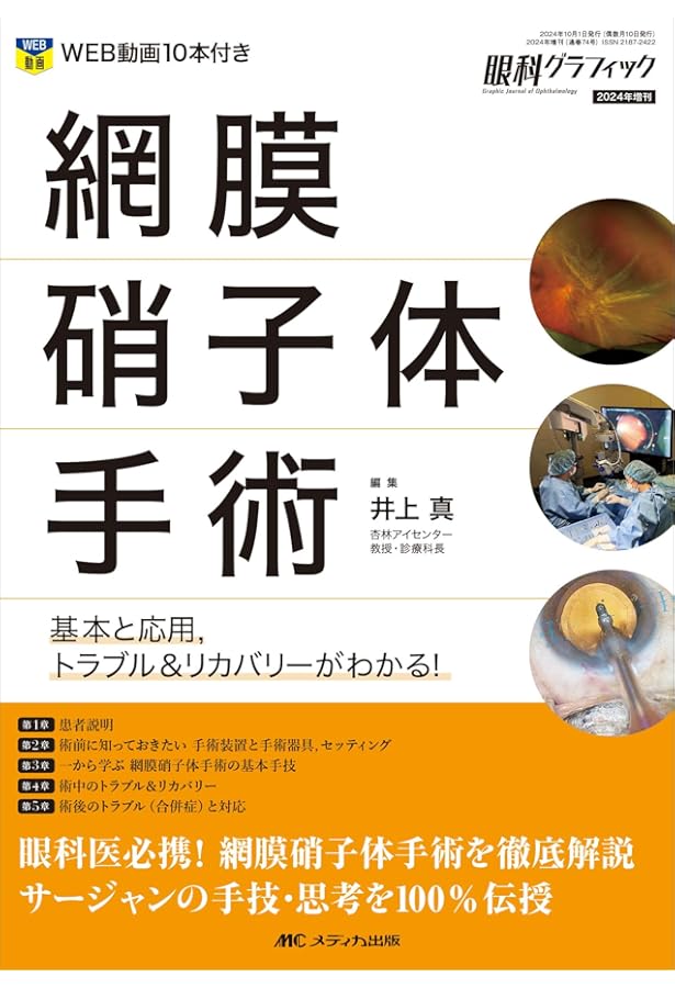 眼科医のための手術解剖 | 林篤志, 三木篤也 |本 | 通販 | Amazon