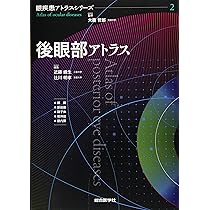 Amazon.co.jp: 前眼部アトラス (眼疾患アトラスシリーズ 第 1巻