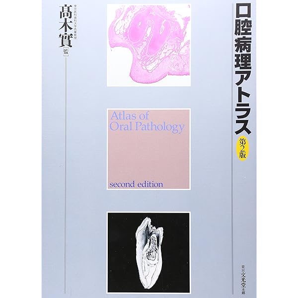 口腔病理アトラス | 高木 實, 高田 隆, 豊澤 悟 |本 | 通販 | Amazon