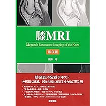 肩関節のMRI−読影ポイントのすべて | 隆士, 佐志, 恵一, 秋田, 栄二