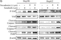 Phospho-YAP (Ser397) (D1E7Y) Rabbit Monoclonal Antibody | Cell