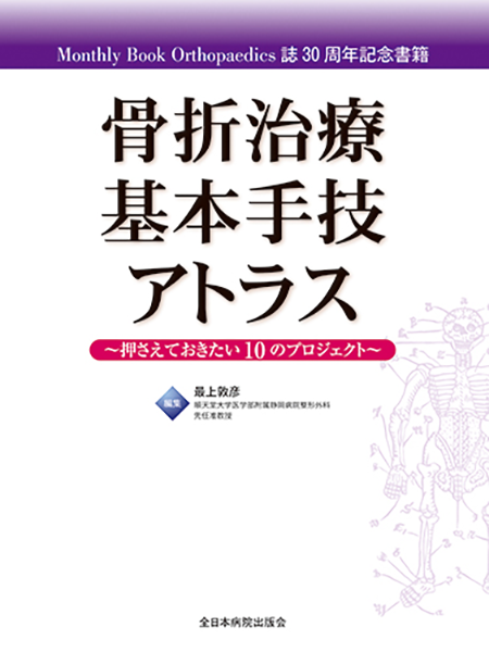m3電子書籍 | 6 骨折治療1：手指骨ピンニング，プレート固定［整形