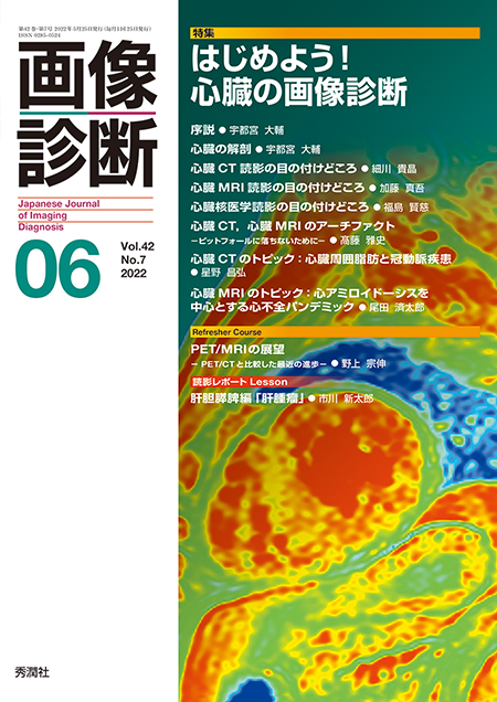 m3電子書籍 | 画像診断 2022年11月号（Vol.42 No.13）これだけは読める