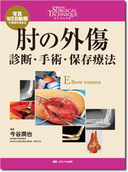 阪和人工関節センターTKAマニュアル Basic Course 阪和人工関節