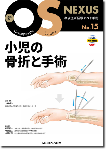 m3電子書籍 | 新OS NEXUS No.7 下肢の骨折手術2 膝～足部［Web動画付］