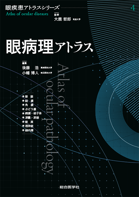 m3電子書籍 | 眼疾患アトラスシリーズ 第1巻 前眼部アトラス