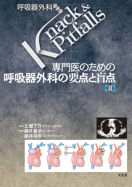 m3電子書籍 | 心臓外科 Knack & Pitfalls 冠動脈外科の要点と盲点 第2版