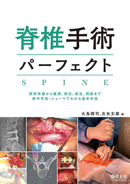m3電子書籍 | 脊椎手術パーフェクト