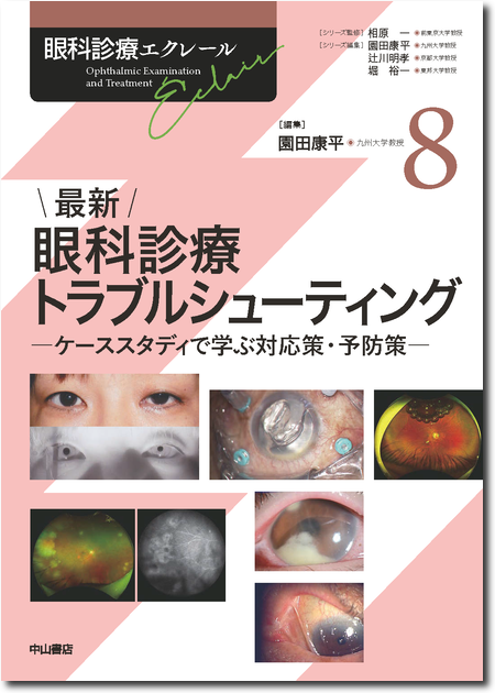 m3電子書籍 | 眼科診療ガイド 第2版