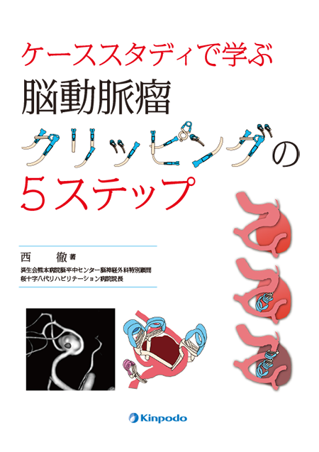 m3電子書籍 | パーフェクトマスター 頚動脈狭窄症