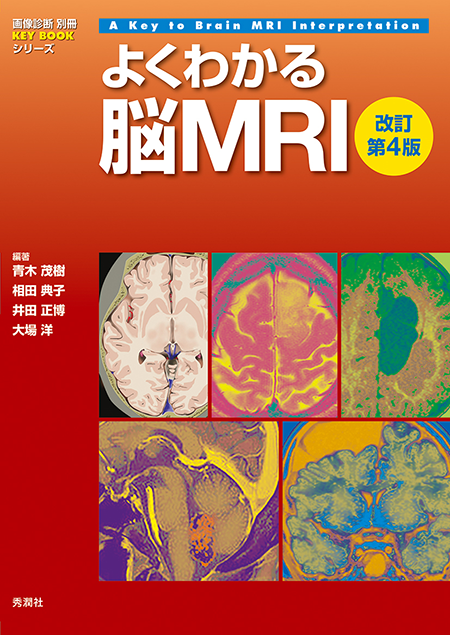 m3電子書籍 | 画像診断別冊 KEY BOOKシリーズ よくわかる脳MRI 改訂第4版