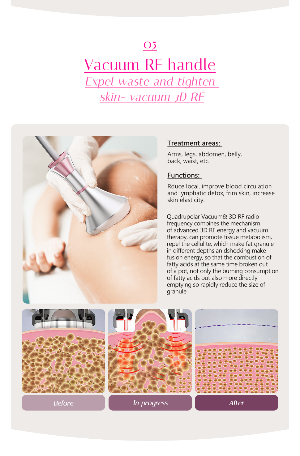 FREYARA 80K RF Ultrasonic Vacuum Cavitation System 6in1, for Fat