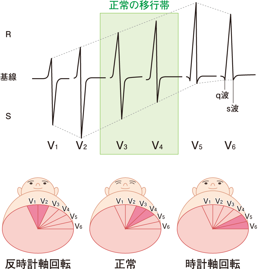 正常心電図｜心電図とはなんだろう（4） | 看護roo![カンゴルー]