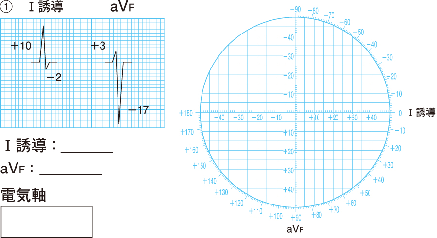 心電図波形の名称と成り立ち｜心電図とはなんだろう（2） | 看護roo