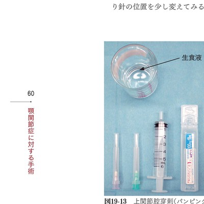 イラストでみる口腔外科手術 第3巻