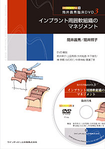 筒井昌秀臨床DVD3 インプラント周囲軟組織のマネジメント
