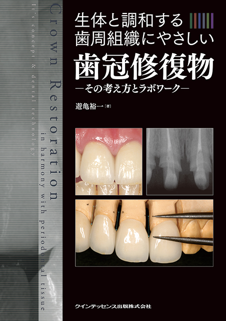 生体と調和する歯周組織にやさしい歯冠修復物 - クインテッセンス出版