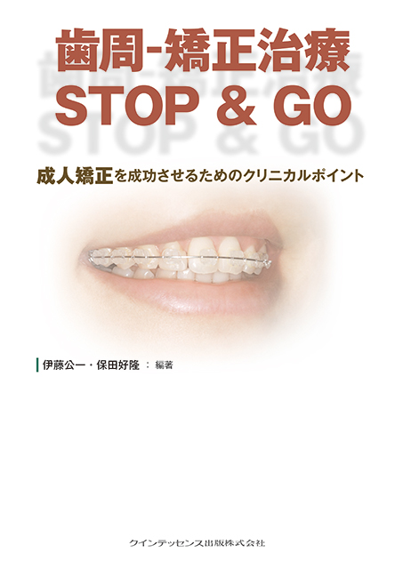 歯周-矯正治療 STOP & GO - クインテッセンス出版