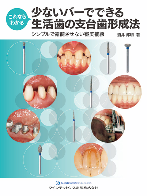 これならわかる 少ないバーでできる生活歯の支台歯形成法