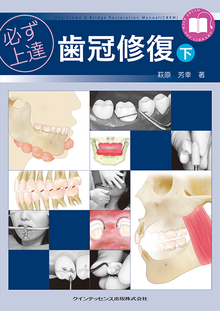 イラストレイテッド 歯冠修復 アドバンステクニック