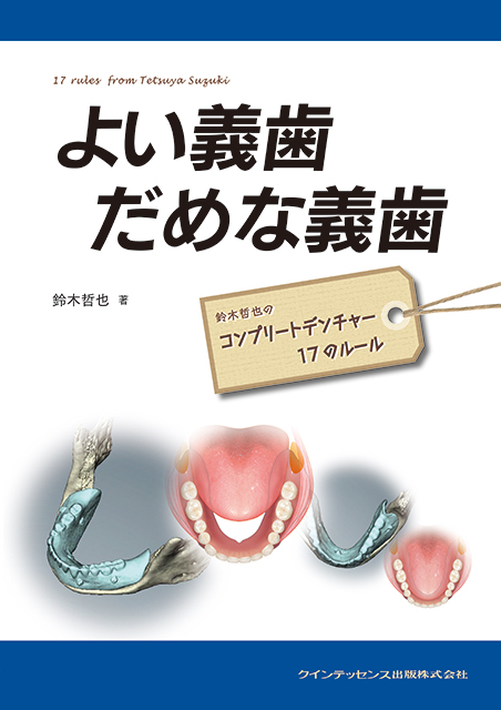 長期症例に学ぶパーシャルデンチャー - クインテッセンス出版