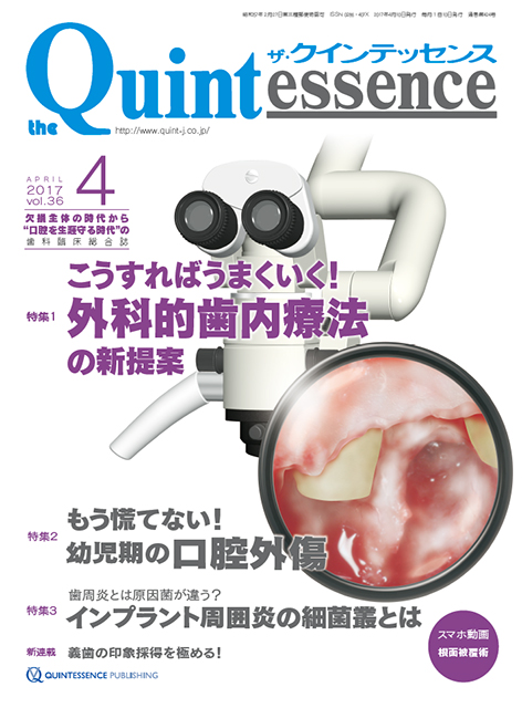 Interdental Papilla Reconstruction - クインテッセンス出版