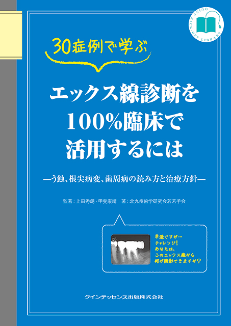 ATLASで学ぶ 歯科用コーンビームCT診断のポイント64