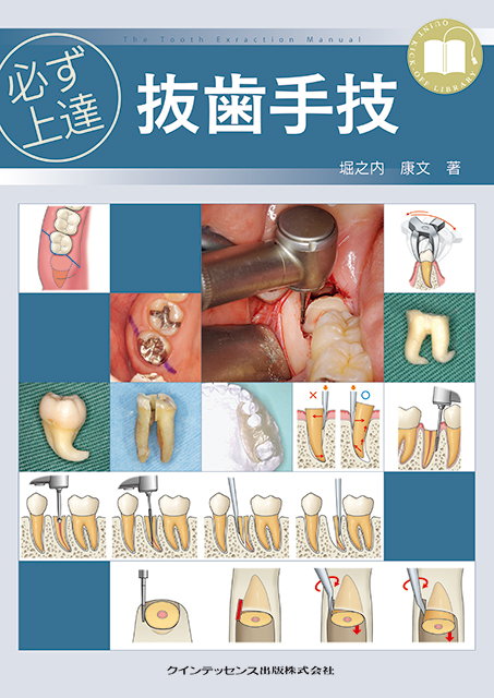 臨床で困らない歯内療法の基礎 - クインテッセンス出版