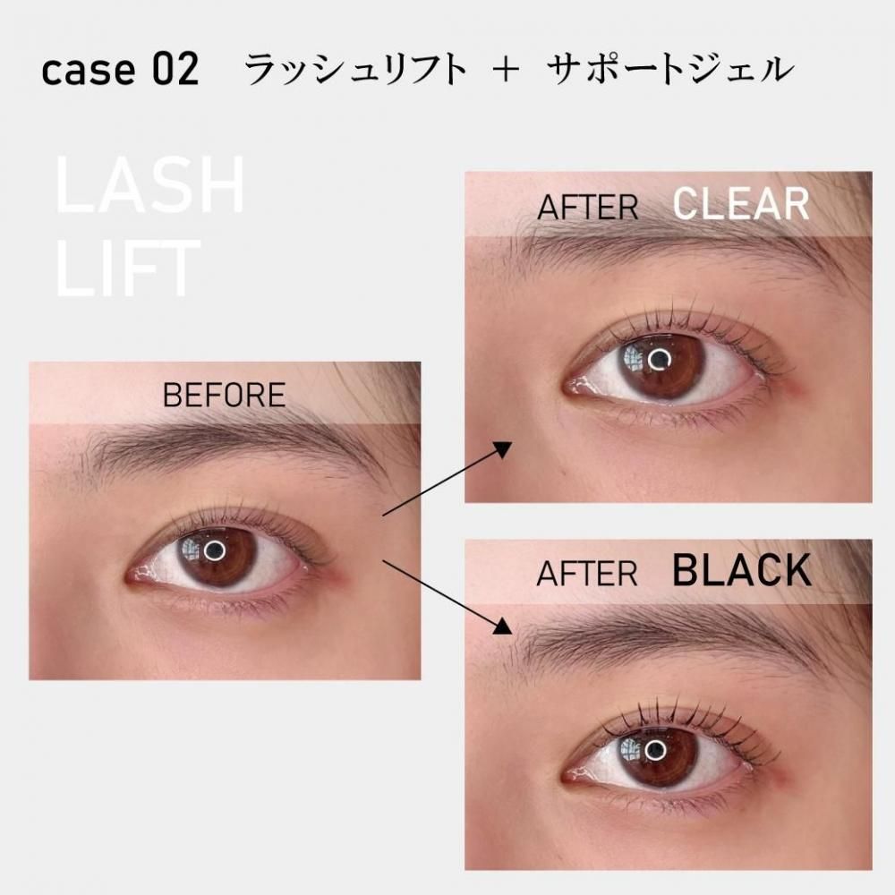 フェニックス アイラッシュサポートジェルの販売ページ