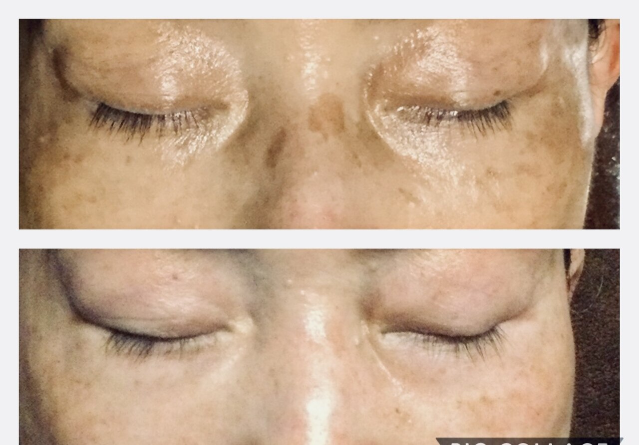 ドクターピュールボーテ 神戸店(Dr. PUR BEAUTE)｜ホットペッパー