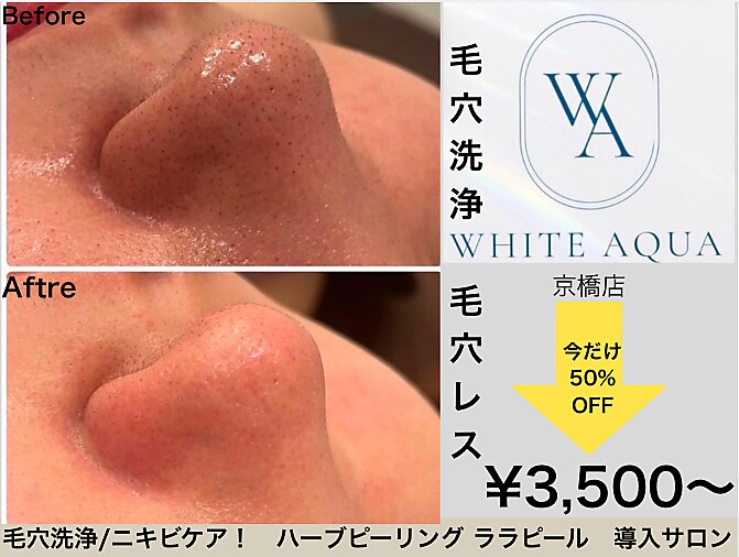ホワイトアクア 京橋店(WHITE AQUA)｜ホットペッパービューティー