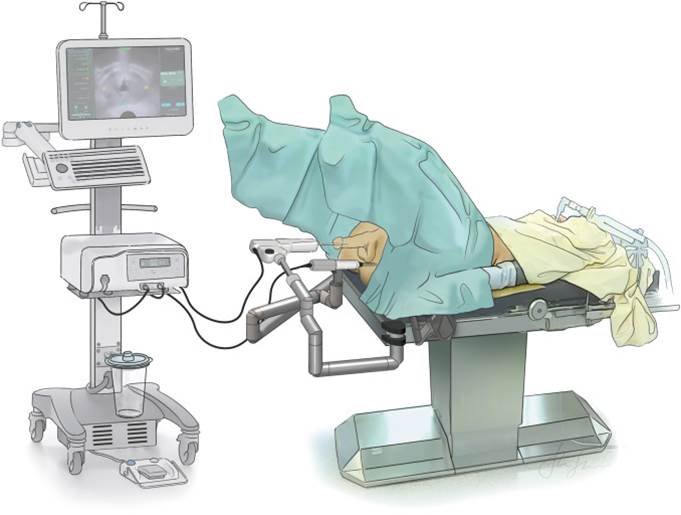 泌尿器科先端治療のご案内 | 泌尿器科 | 診療科のご案内 | 板橋中央