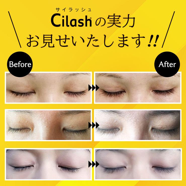 レビューを書いて半額返金】まつ毛美容液 サイラッシュ 3ml まつげ