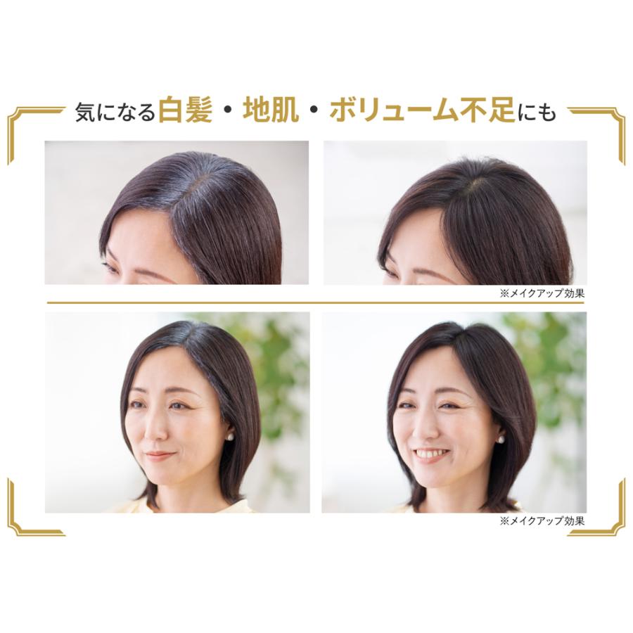 アートネイチャー 白髪隠し 薄毛 女性 アートミクロン プラビ パウダー