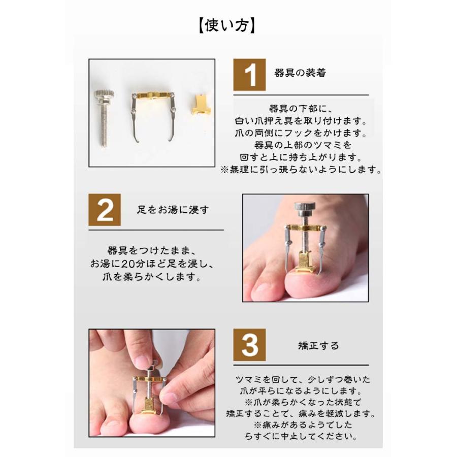 巻き爪 矯正 2個セット 収納ケース付き サポート 器具 ネイルケア