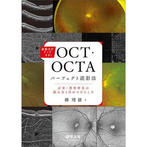 診断力がアップする!OCT・OCTAパーフェクト読影法 正常・異常所見の