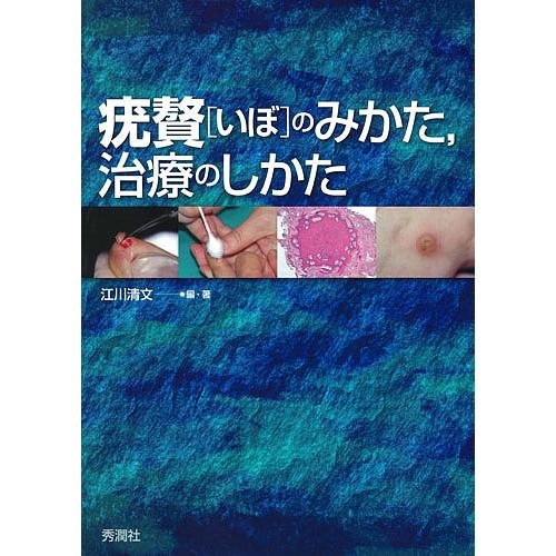 疣贅(いぼ)のみかた,治療のしかた/江川清文 : bookfanプレミアム