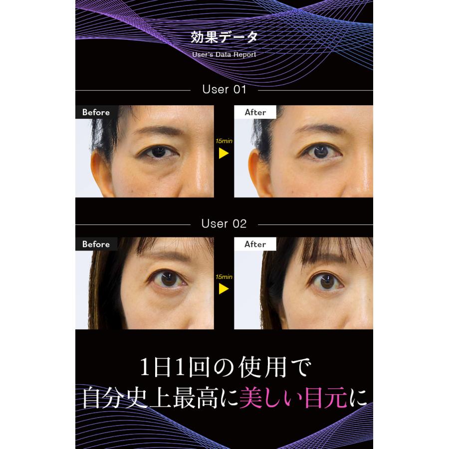 LUXCEAR（ルクセア） 【公式】目元専用美顔器 ミューサー 目元専用美顔