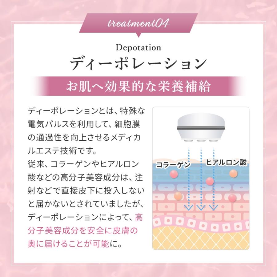 ベレガ（BELEGA） 【正規品販売店】【シリアル付＆保証付】ベレガ