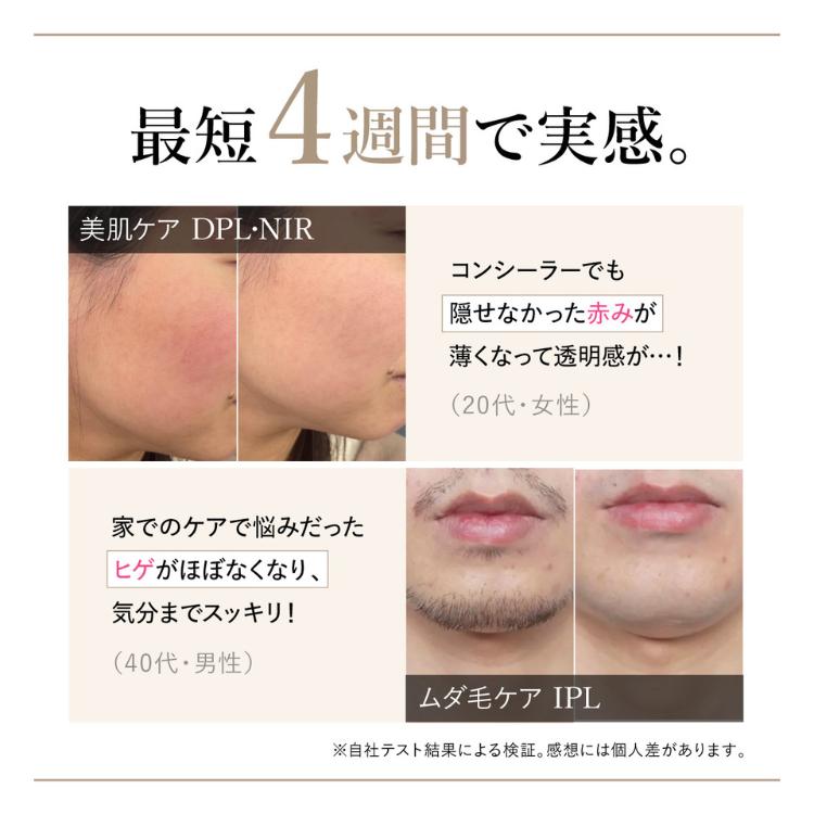 WAVEWAVE WAVEWAVE Radiant Grace 光脱毛器 光美容器 IPL NIR DPL VIO