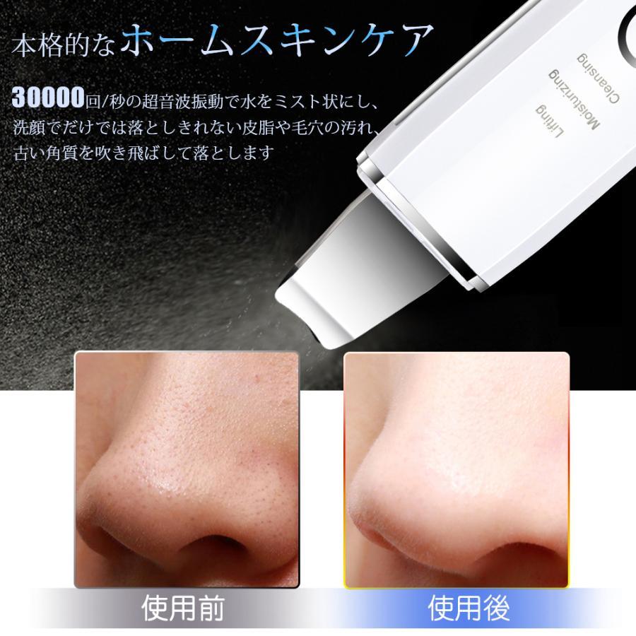 ウォーターピーリング 美顔器 リフトアップ 超音波 ウオーターピーラー