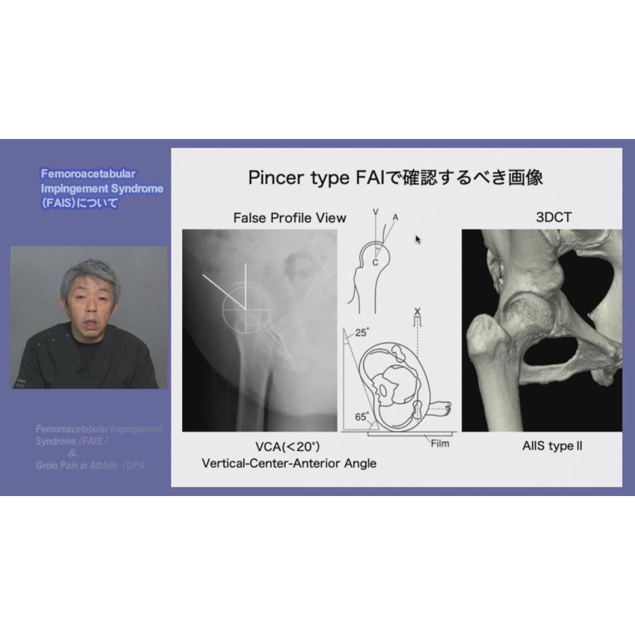ジャパンライム アスリートにおける股関節痛・鼠蹊部痛の評価と治療