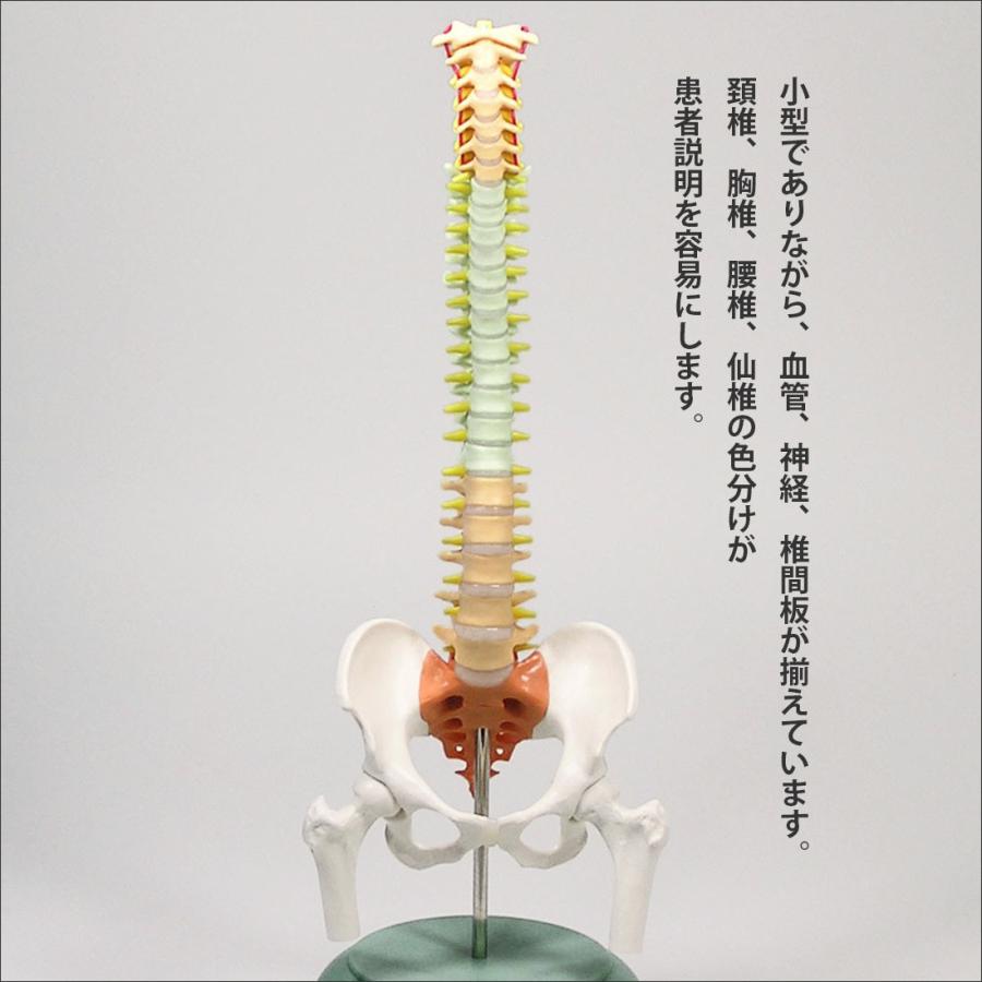 脊柱模型」卓上サイズ スマート脊柱模型 医学模型 解剖学模型 疾患説明