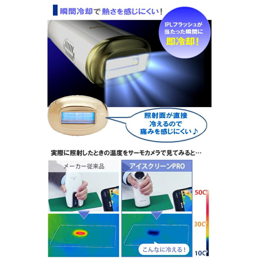 アデランス TVで紹介 DoRAISE アイスクリーンPRO IPL光美容器 脱毛器