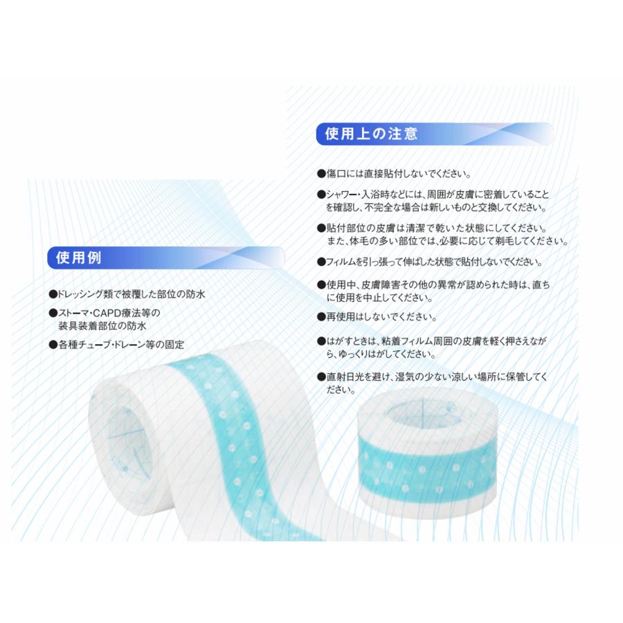 ニトムズ Nitto 優肌 パーミロール(ハンディロールタイプ) H24R10 10cm