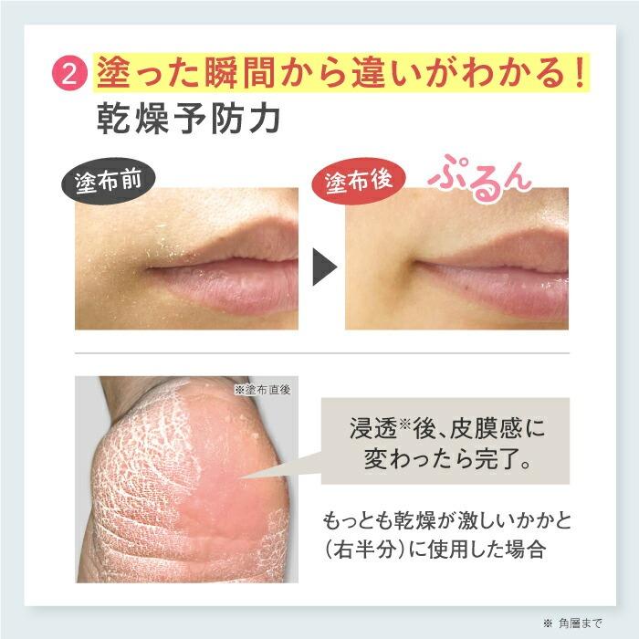 Mediplus（メディプラス） 【公式】メディプラス オールインワンジェル