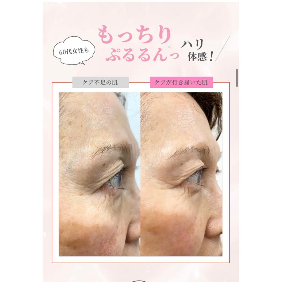 nano PDS アイロニングフェイスクリーム NMN、エクソソーム配合