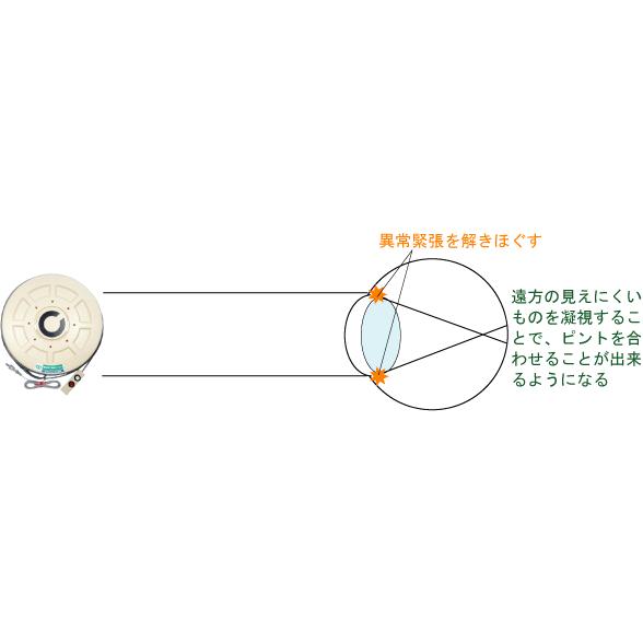 近視/遠視/弱視/乱視の視力回復】【アングルビジョントレーニング機器