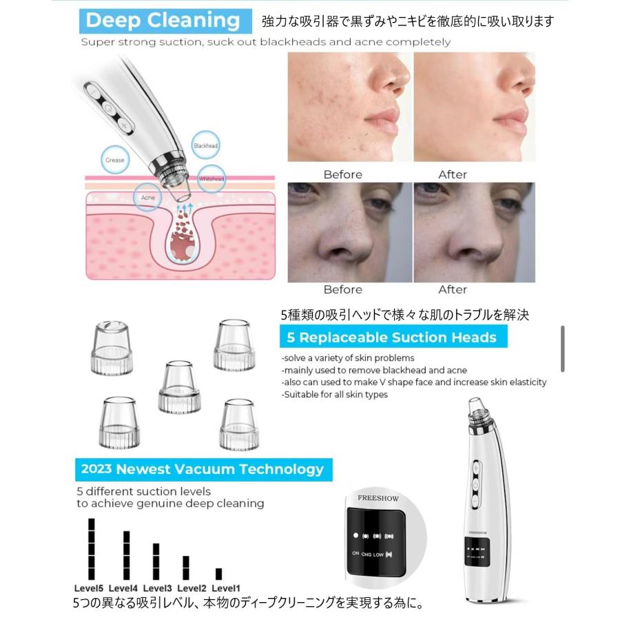 吸引器 ニキビ 毛穴吸引 角質 角栓 ニキビケア 美顔器 5段階吸引力